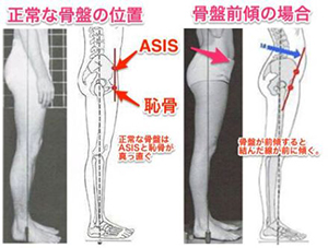 >仰向けで寝ると腰が浮く