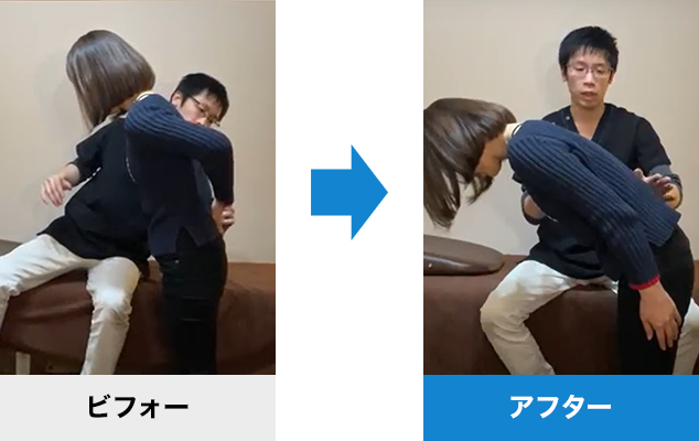 腰が前に倒せない患者様のビフォーアフター